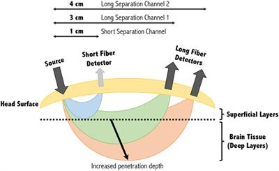 Shining a Light on Awareness: A Review of Functional Near-Infrared Spectroscopy for Prolonged Disorders of Consciousness